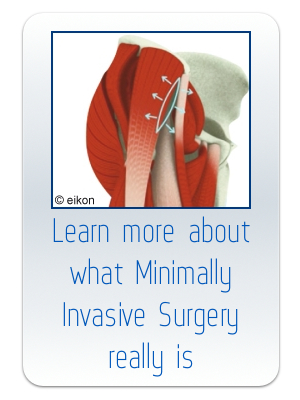 Learn More about Minimally Invasive Surgery