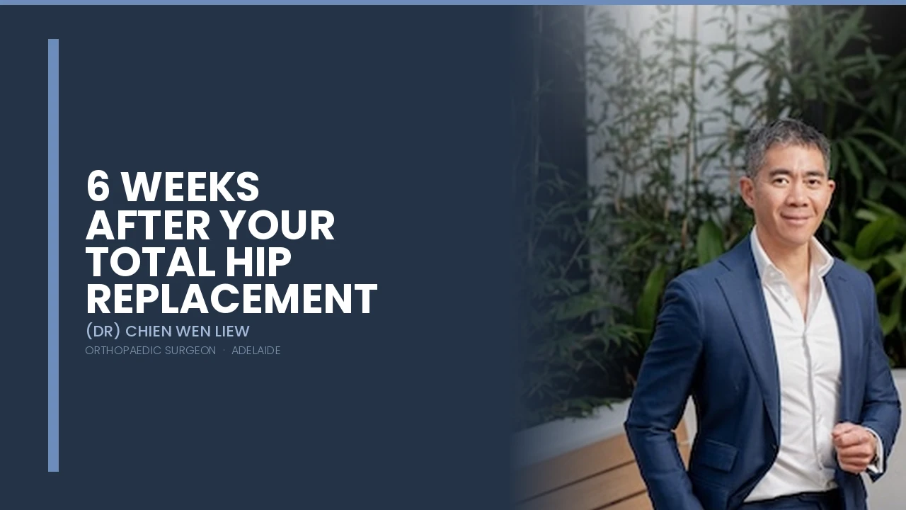 6 weeks after total hip replacement recovery guide