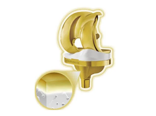 Medacta SensiTiN GMK knee implant — gold titanium nitride coating