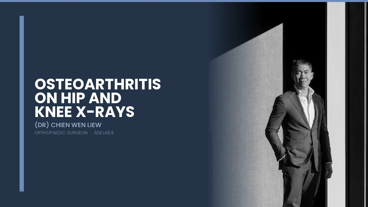 Osteoarthritis on Hip and Knee Xrays — Dr Chien-Wen Liew Adelaide