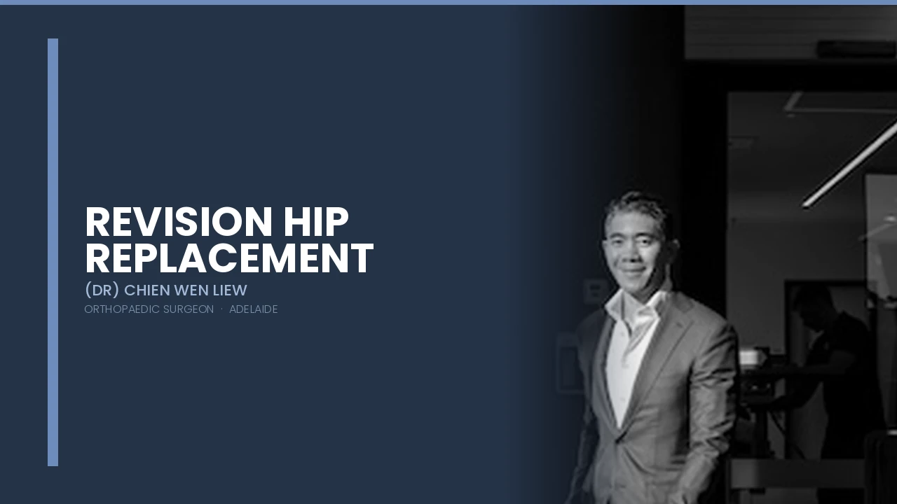 Revision Hip Replacement - Dr Chien-Wen Liew Adelaide